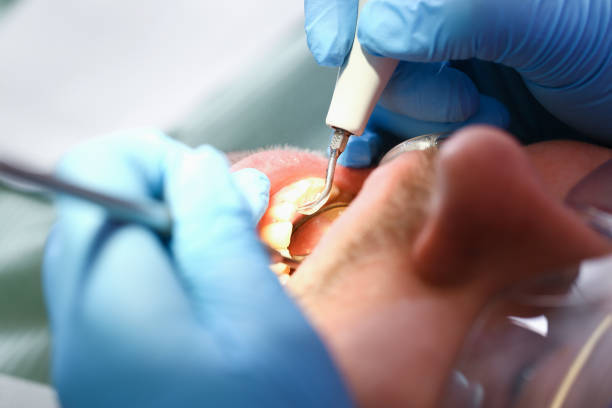 Best Emergency TMJ Treatment in Pimmit Hills, VA