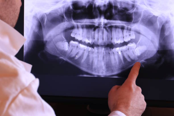 Best After-Hours Dental Trauma Care in Pimmit Hills, VA