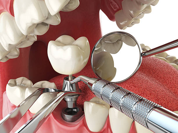 Best Emergency TMJ Treatment in Pimmit Hills, VA